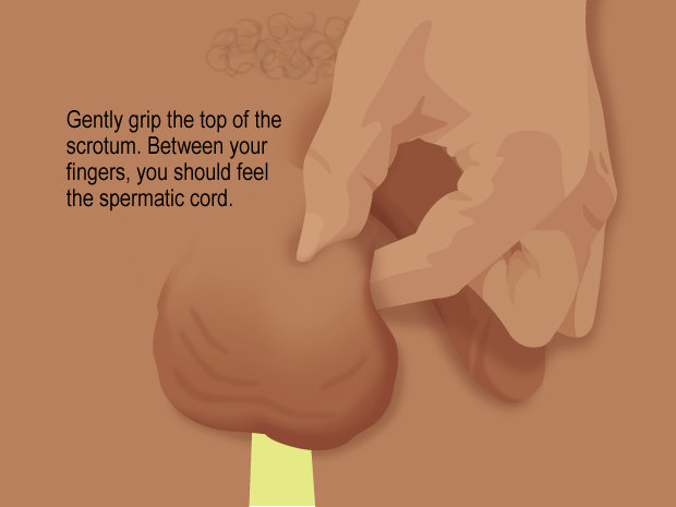Examine one testicle at a time.

Start by gently gripping the top of the scrotum, with your thumb on top and your fingers underneath. Pinch gently so that the testicle stays put and won't move during the exam.

Between your fingers, you should feel the spermatic cord. This connects the testicle to the rest of your body.