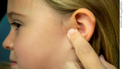 semilla Odiseo Tropical Cómo ponerle a su hijo gotas para los oídos (para Padres) - Nemours  KidsHealth