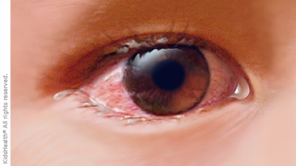 Mal de ojo: ¿Qué es, cuáles son sus síntomas y cómo prevenirlo?