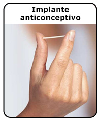 anticonceptivo (para Adolescentes) - Nemours