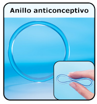 Pensar Precioso pegatina Anillo anticonceptivo (para Adolescentes) - Nemours KidsHealth