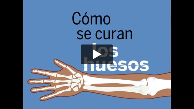 (AD) Cómo se curan las fracturas de huesos