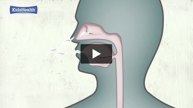 Ataques de asma: ¿Qué sucede?