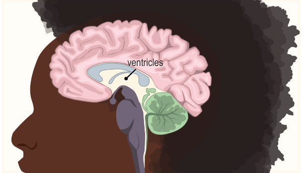 thumbnail image 2 of Change Your Brain, Change Your Body: Use Your Brain To Get And Keep The Body You Have Always Wanted – Daniel G. Amen – Very Good Condition 2 of 9