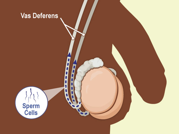 Sperm stay in the epididymis until a man has an erection (when the penis fills with blood and gets hard).  When the penis is hard, muscles push sperm from the epididymis into a tube called the vas deferens.