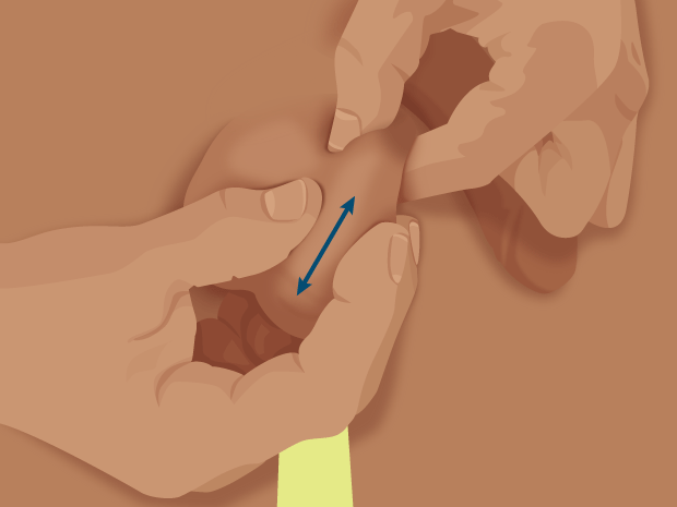 With your free hand, glide your thumb and fingers along both sides of the testicle, from top to bottom. Feel for any lumps or bumps.Then, glide your fingers over the front and back of the testicle.On the back at the top, you should feel the epididymis, a tube that carries sperm. This is a normal lump and may feel tender to the touch.