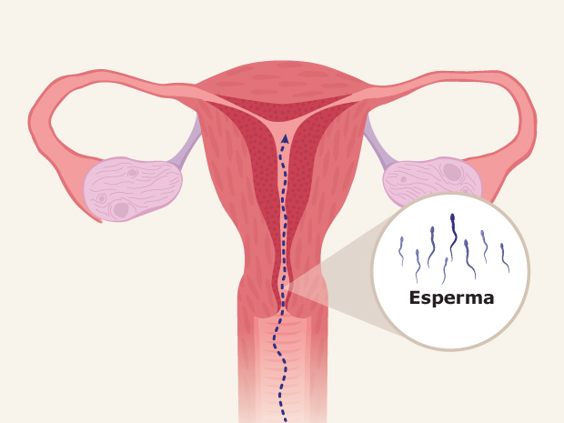Durante las relaciones sexuales, el esperma pasa por la vagina y el útero hasta llegar a las trompas de Falopio.

En la trompa de Falopio, el esperma se une con el óvulo que se liberó durante la ovulación del ovario.