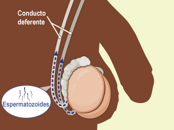 El conducto deferente es un tubo muscular delgado que transporta los espermatozoides del epidídimo a la uretra.