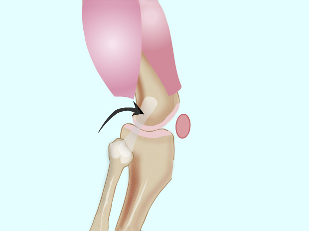 Los ligamentos son bandas fibrosas y largas que unen los huesos.