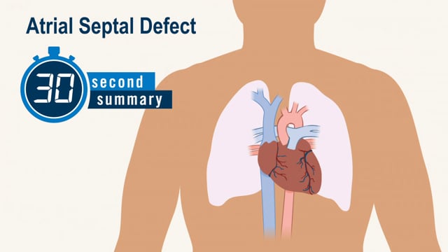 30-Second Summary: Atrial Septal Defect