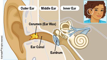 Dealing With Earwax (for Parents) - Nemours KidsHealth