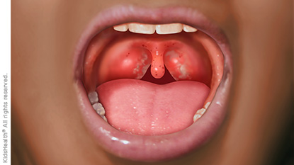 Inside of mouth showing normal throat and tonsils - Stock Image