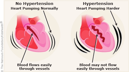 does high blood pressure cause heart racing)