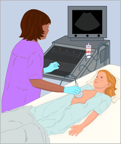 ultrasound_illustration