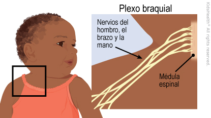 Se muestran los nervios del plexo braquial dentro del cuerpo que se extienden desde la médula espinal hacia el hombro, el brazo y la mano.