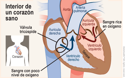 Se muestran dos ilustraciones. La primera muestra la posición del corazón en el cuerpo y la segunda muestra un corte transversal de un corazón sano. La sangre rica en oxígeno fluye desde la aurícula izquierda hacia el ventrículo izquierdo y luego se dirige hacia la aorta, mientras que la sangre pobre en oxígeno fluye desde la aurícula derecha hacia el ventrículo derecho y, a través de una válvula, va hacia la arteria pulmonar. 